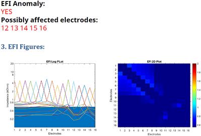 Improving the sensitivity of cochlear implant integrity testing by recording electrode voltages with surface electrodes